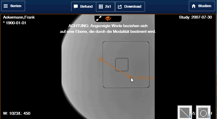 Projektions Radiografie
